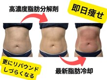 ホワイトビューティーラボ(White Beauty Lab)/高濃度脂肪分解剤で即日痩せ