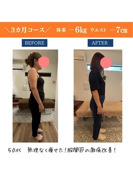 ラサンテ整体院(La Sante)/50代女性/-6キロで腰痛改善!