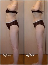 アンフィニ(infini)/短期集中10回コース（3ヶ月）