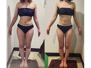 アユアランリンク 錦糸町店/C様：普通体型でもこの変化！