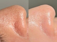 ルーナジェーナ(Luna llena)/池袋　エステ　ルーナジェーナ