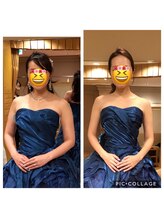 ローズボディ 恵比寿店/小顔＆二の腕バストアップ