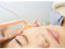 プラズマが真皮にアプローチを一気に起こすことで肌質改善が可能