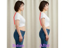 述べ5万人を施術してきた専門院ならではの結果重視の姿勢・骨盤・小顔矯正！ここなら間違いなし！！