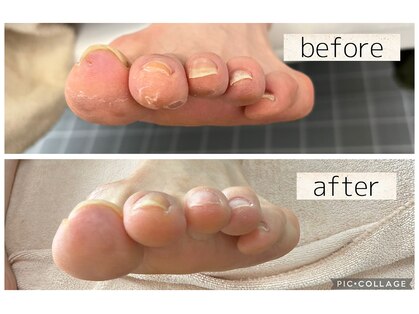 ベーネ(bene)の写真