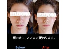 美容矯正サロン レレポノ(LELEPONO)/