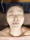 綺麗屋紫音の写真/《ツヤ肌フェイシャル》コラーゲン生成を促進し、ハリ・ツヤ・美白を実現!透明感溢れる陶器美肌に♪
