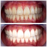 ホワイトベース(White base)