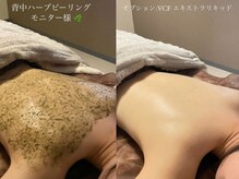 アメリ(Amelie)の雰囲気（今大人気の背中ハーブピーリング★ブライダルや夏のお出かけ前に）