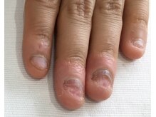 ネイルアンドアイラッシュ アヴィ(Nail and Eyelash A'vi)/自爪育成コース/１回目