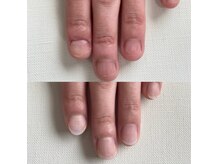 ネイルデコ(nail DECO)の雰囲気（人気の自爪育成。深爪/噛む癖、短い爪も自然な見た目で育成可能）