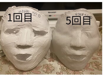 パール/石膏パックのビフォーアフター