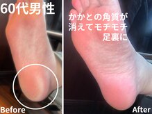 大人ネイル/フットケア