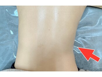 チャヨン/リンパマッサージ