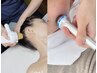 韓国で最も話題の【テラノバ】【水玉リフティング】で小顔＆透明感ある美肌に