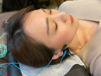 ゆしんアネックスの写真/【リフトアップ美容鍼+小顔ストレッチ】実年齢より老けて見える、フェイスラインが気になる方にオススメ◎