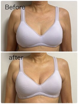 ベッピン(Beppin)/静岡バストアップ/静岡育乳