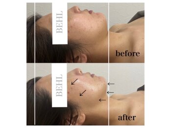 ベール(BEHL)/コルギのBefore After