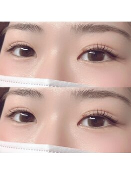 ミシェル(MICHELL)の写真/まつ毛の少ない方や細い方・取れやすくて悩んでる方にオススメ！汗と水に強い最新LED使用★