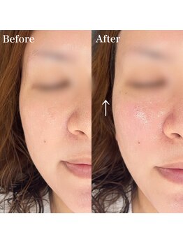 フィーノ(fino.)/夏に向けて♪