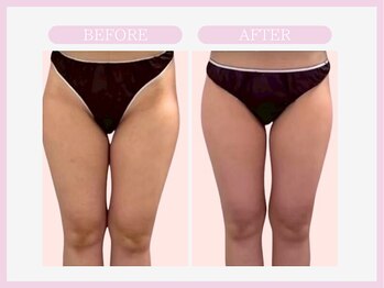 アコガレコガオ 青森店/