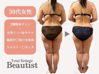 トータルエステティック ビューティスト 足利店(Total Easthetic Beautist)/30代女性Before＆After