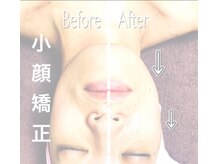 allハンド小顔矯正★来店後のご相談でメニュー変更可★老化対策