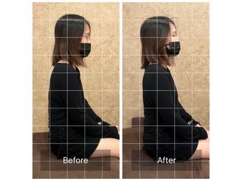 トラスト整体院 小池院/20代/女性/アパレル/反り腰