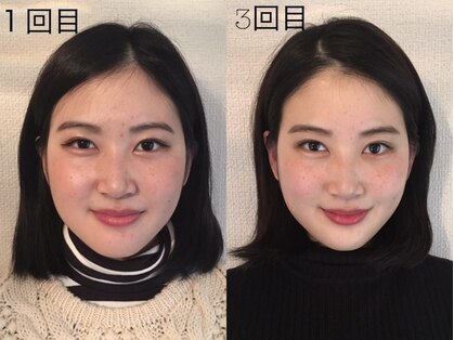 ミヌレ 大阪店(minulle)の写真