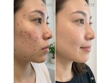 マイスタイル(My style Beauty)