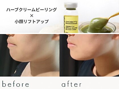 ソラ(Sora)の写真