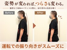 ピースフルポイント(Peaceful Point)の雰囲気（首肩の痛みが減ると運転の時の目視も楽でした）