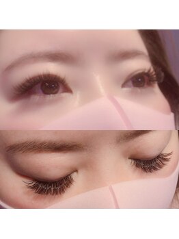 フローラ(FLORA)/