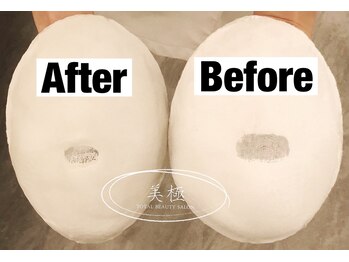 美極 トータルビューティー(美極 TOTAL BEAUTY)/恵比寿/小顔コルギ/エステ/