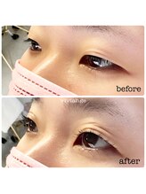 ヴィヴィアンジュ(viviange)/ラッシュリフト