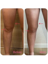 リエット(Lieto)/むくみ改善！！！！！