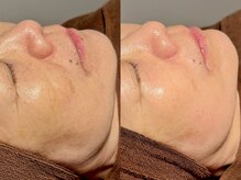 ルーナジェーナ(Luna llena)/池袋　エステ　ルーナジェーナ