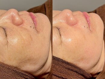 ルーナジェーナ(Luna llena)/池袋　エステ　ルーナジェーナ