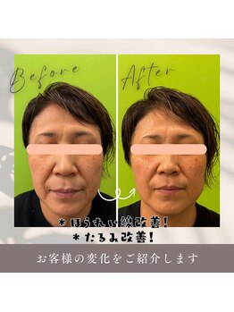 北てんま整骨鍼灸院/効果抜群!