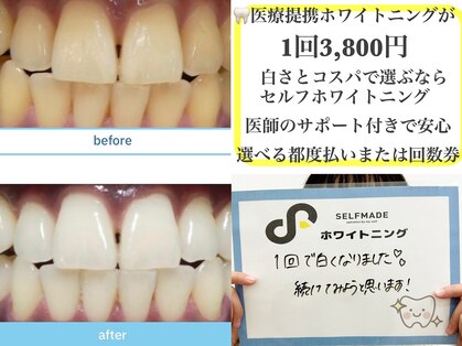 セルフメイド イオンタウン防府店(SELF MADE)の写真