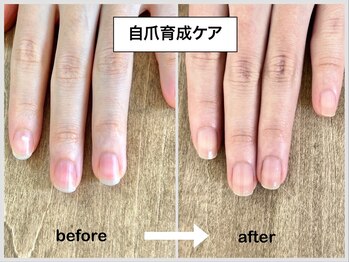 コバコ(kobaco)/自爪育成ケア　半年間の成果比較