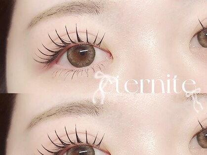 エテルニテ(eternite)の写真