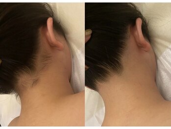 グラント ふじみ野店(grant)/