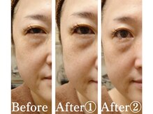 サロンドエステ ルヴニール(salon de esthe revenir)の雰囲気（一度のビフォーアフター。目元もすっきり♪）