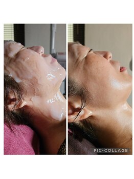 ミホズルーム(Miho‘s room)/炭酸パック