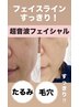 【超音波フェイシャル】たるみ肌にアプローチ!リフトアップ効果絶大★