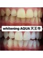 アクア 天王寺店(AQUA) ホワイトニング/ホワイトニング専門店/天王寺/ホワイトニング
