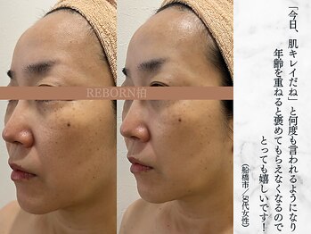 リボーン 柏(REBORN)/冬枯れ肌をうるおいで満たすケア