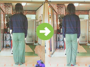 サプライズ整体院/20代ママの初回産後の骨盤矯正