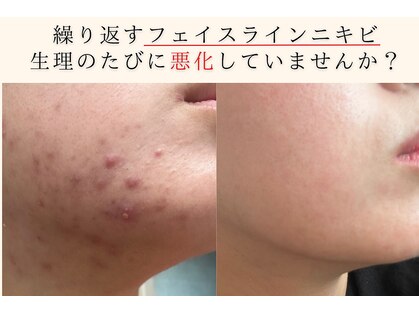 アエオボンヌール(A.E.O BONHEUR)の写真